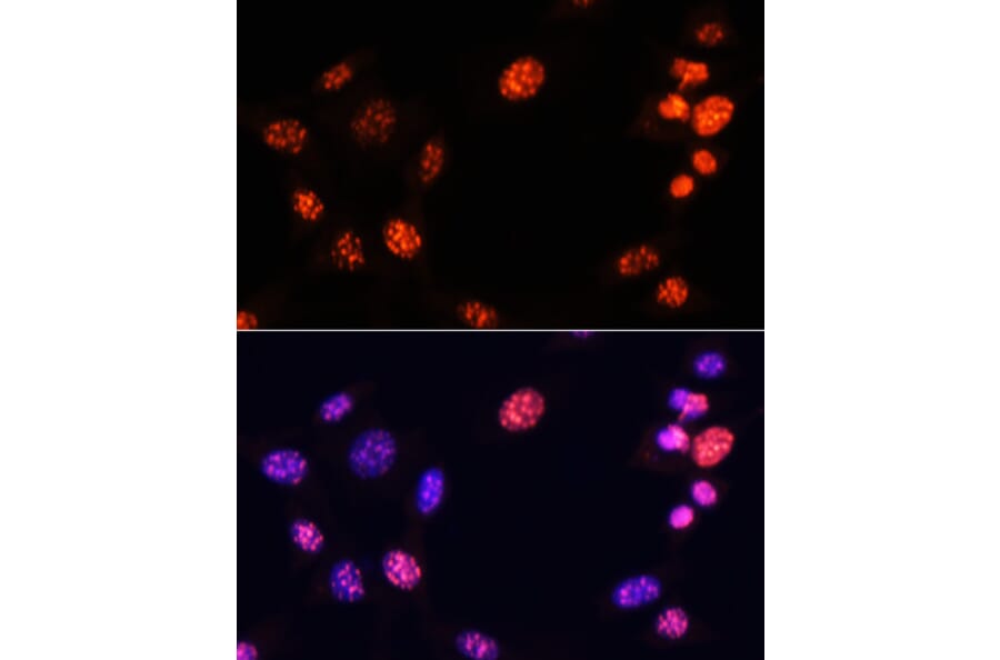 Immunofluorescence - Anti-Histone H3 (tri methyl Lys64) Antibody (A91767) - Antibodies.com