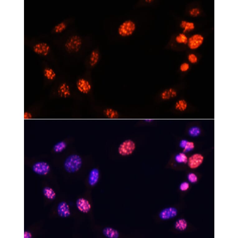 Immunofluorescence - Anti-Histone H3 (tri methyl Lys64) Antibody (A91767) - Antibodies.com