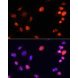 Immunofluorescence - Anti-Histone H3 (tri methyl Lys64) Antibody (A91767) - Antibodies.com