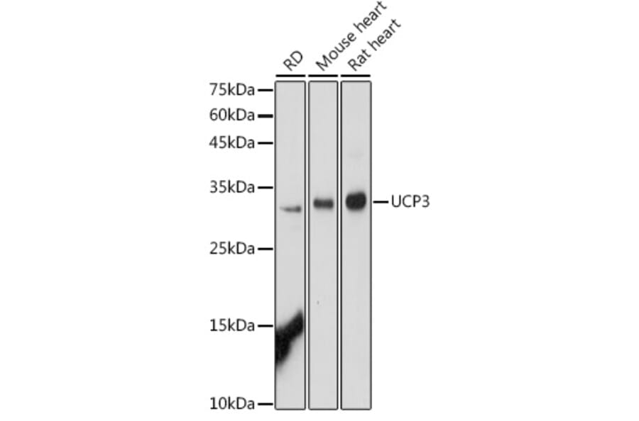 Western Blot - Anti-UCP3 Antibody (A91768) - Antibodies.com