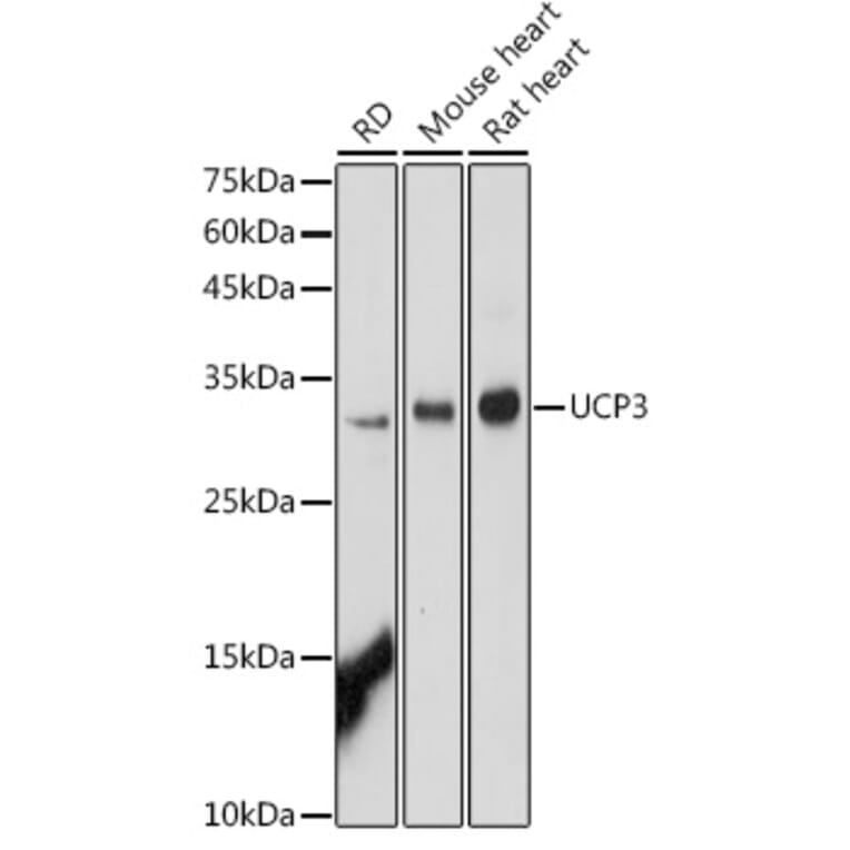 Western Blot - Anti-UCP3 Antibody (A91768) - Antibodies.com