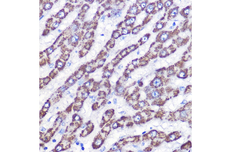Immunohistochemistry - Anti-UCP3 Antibody (A91768) - Antibodies.com