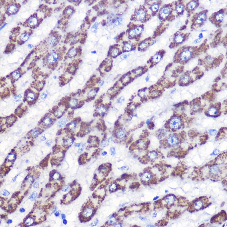 Immunohistochemistry - Anti-UCP3 Antibody (A91768) - Antibodies.com