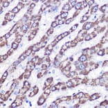 Immunohistochemistry - Anti-UCP3 Antibody (A91768) - Antibodies.com