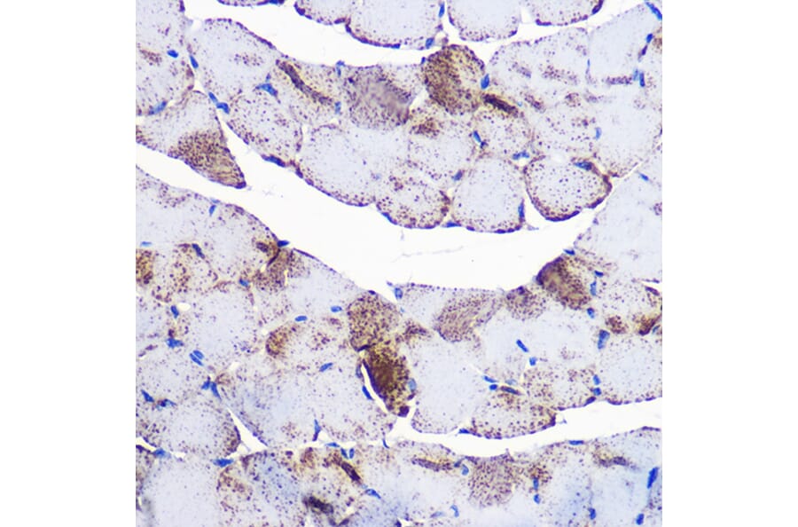 Immunohistochemistry - Anti-UCP3 Antibody (A91768) - Antibodies.com