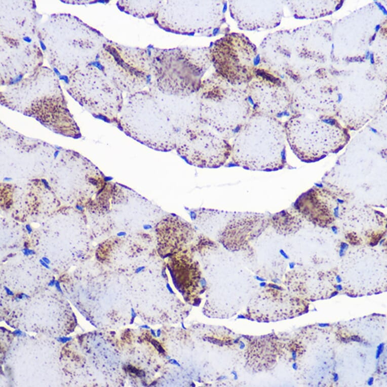 Immunohistochemistry - Anti-UCP3 Antibody (A91768) - Antibodies.com