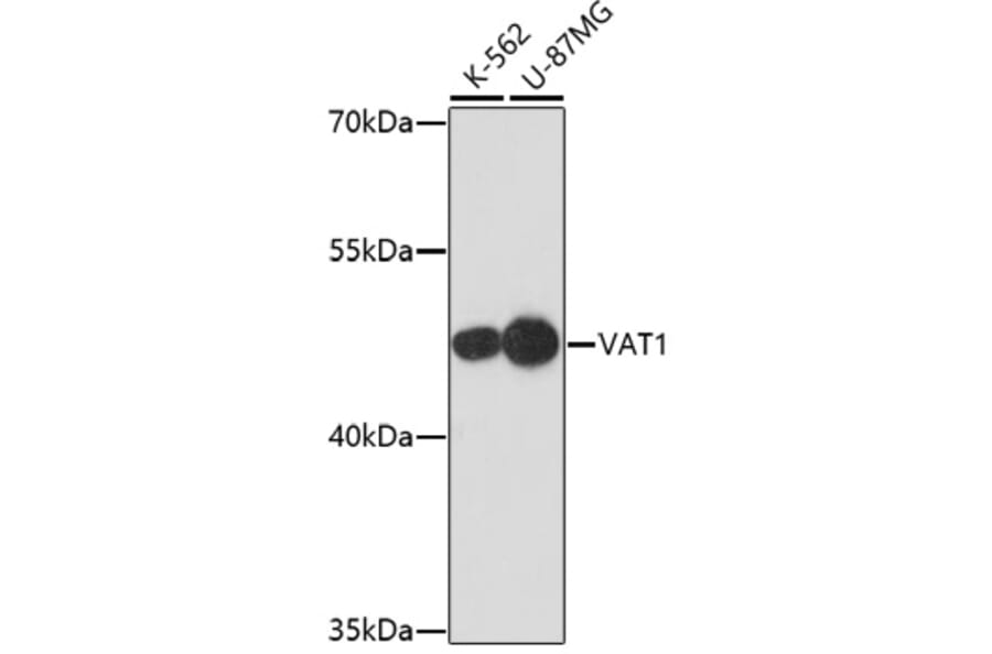 Western Blot - Anti-VAT1 Antibody (A91769) - Antibodies.com