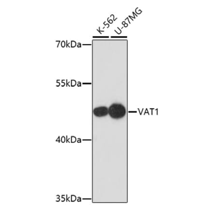 Western Blot - Anti-VAT1 Antibody (A91769) - Antibodies.com