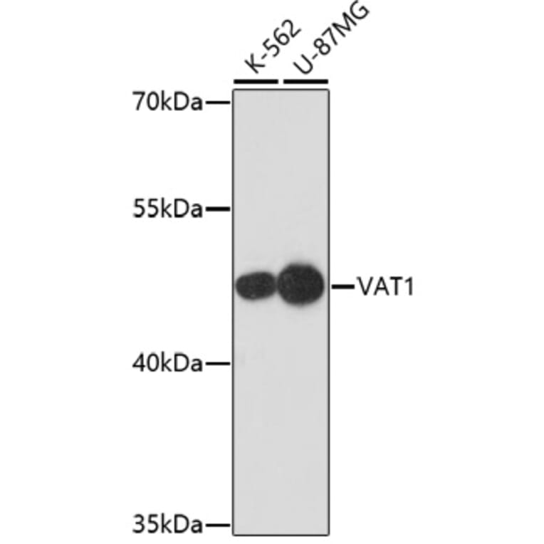 Western Blot - Anti-VAT1 Antibody (A91769) - Antibodies.com