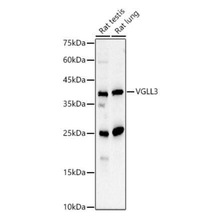 Western Blot - Anti-VGLL3 Antibody (A91770) - Antibodies.com