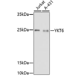 Western Blot - Anti-YKT6 Antibody (A91772) - Antibodies.com