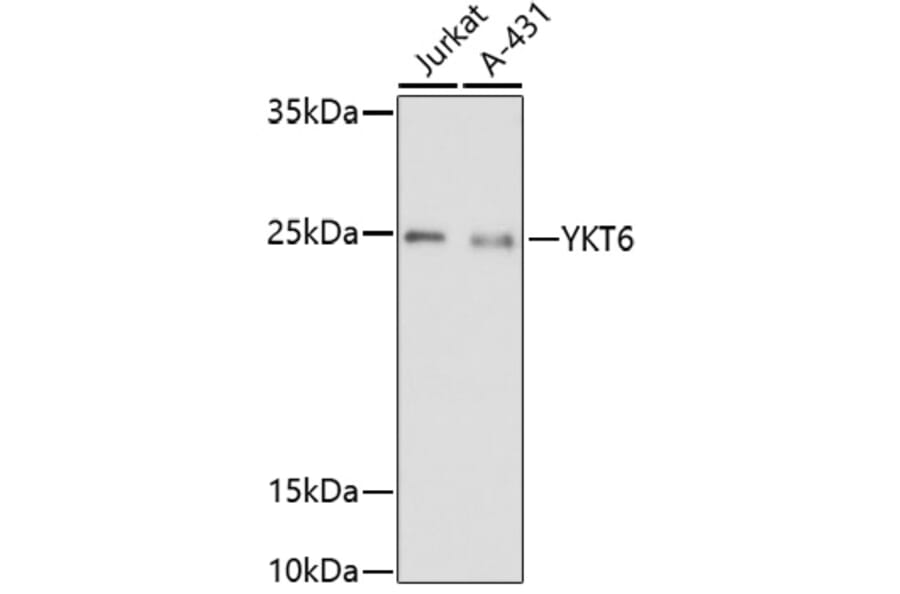 Western Blot - Anti-YKT6 Antibody (A91772) - Antibodies.com