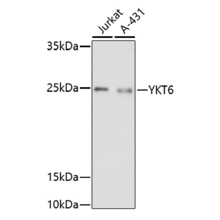Western Blot - Anti-YKT6 Antibody (A91772) - Antibodies.com
