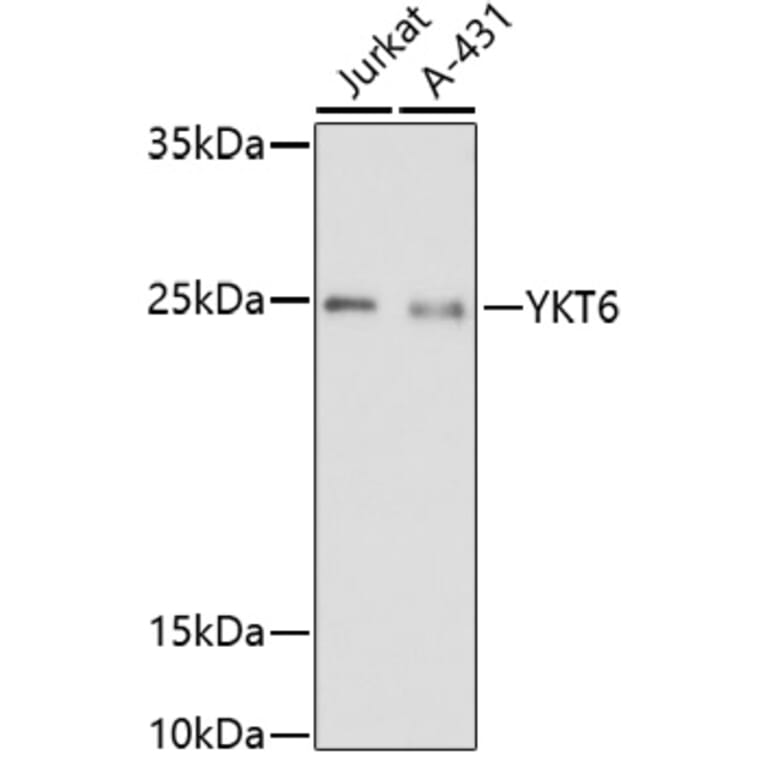 Western Blot - Anti-YKT6 Antibody (A91772) - Antibodies.com