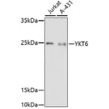 Western Blot - Anti-YKT6 Antibody (A91772) - Antibodies.com