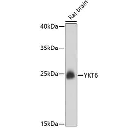 Western Blot - Anti-YKT6 Antibody (A91773) - Antibodies.com