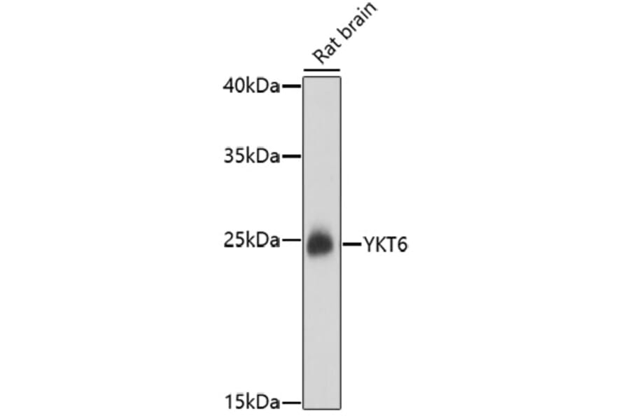 Western Blot - Anti-YKT6 Antibody (A91773) - Antibodies.com