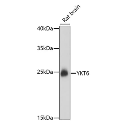 Western Blot - Anti-YKT6 Antibody (A91773) - Antibodies.com