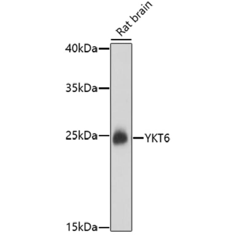 Western Blot - Anti-YKT6 Antibody (A91773) - Antibodies.com