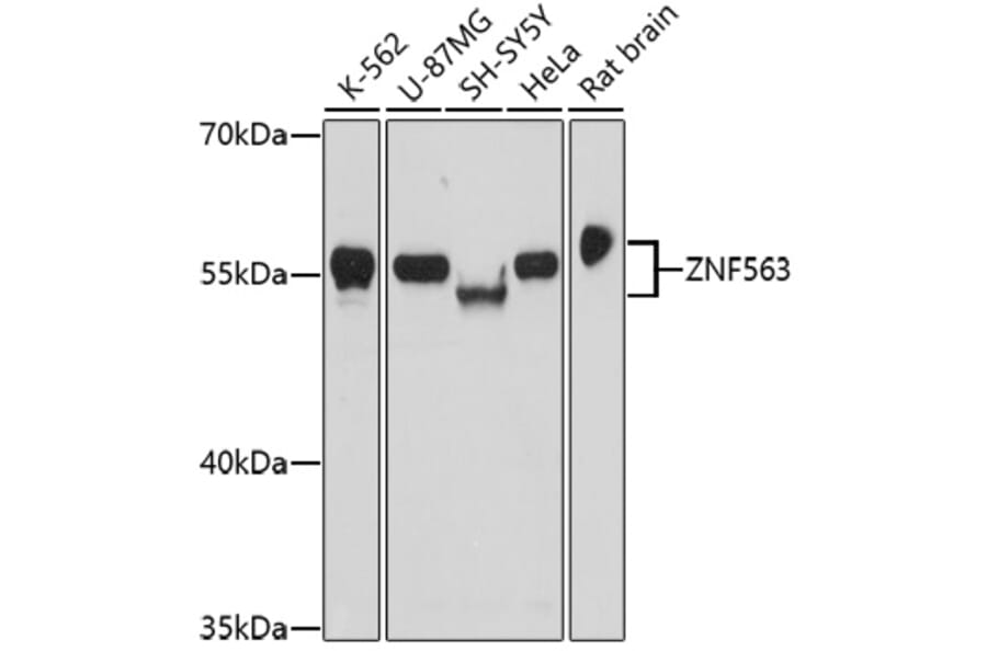 Western Blot - Anti-ZNF563 Antibody (A91774) - Antibodies.com