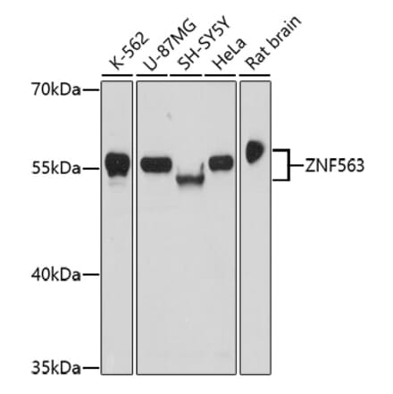 Western Blot - Anti-ZNF563 Antibody (A91774) - Antibodies.com
