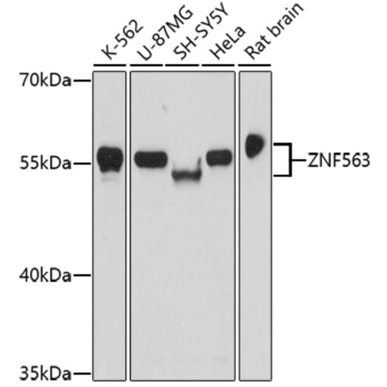 Western Blot - Anti-ZNF563 Antibody (A91774) - Antibodies.com