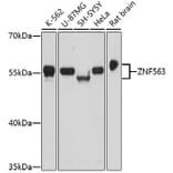 Western Blot - Anti-ZNF563 Antibody (A91774) - Antibodies.com
