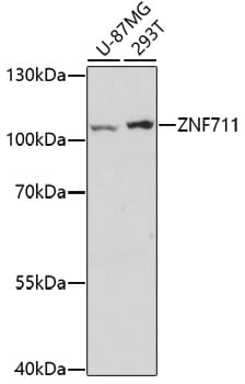 Western blot analysis of extracts of various cell lines, using Anti-ZNF711 Antibody (A17008) at 1:1,000 dilution.
Secondary antibody: Goat Anti-Rabbit IgG (H+L) (HRP) (AS014) at 1:10,000 dilution.
Lysates / proteins: 25µg per lane.
Blocking buffer: 3% non-fat dry milk in TBST.
Detection: ECL Enhanced Kit (RM00021).
Exposure time: 3min.