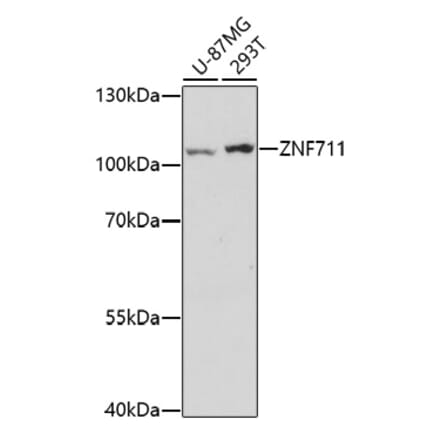 Western Blot - Anti-ZNF711 Antibody (A91775) - Antibodies.com