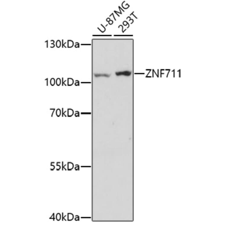 Western Blot - Anti-ZNF711 Antibody (A91775) - Antibodies.com