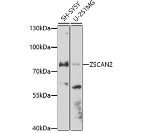 Western Blot - Anti-ZSCAN2 Antibody (A91776) - Antibodies.com