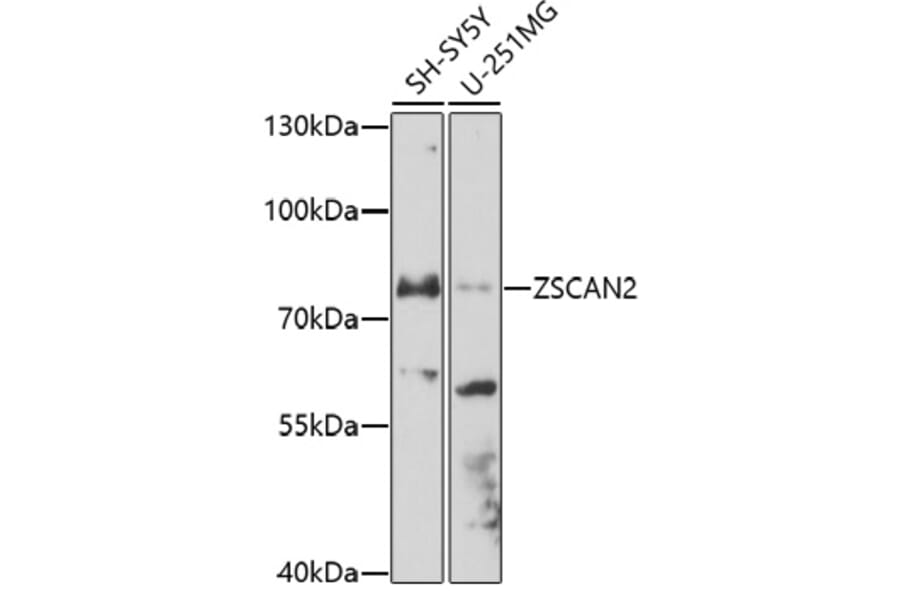 Western Blot - Anti-ZSCAN2 Antibody (A91776) - Antibodies.com