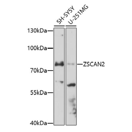 Western Blot - Anti-ZSCAN2 Antibody (A91776) - Antibodies.com