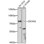Western Blot - Anti-ZSCAN2 Antibody (A91776) - Antibodies.com
