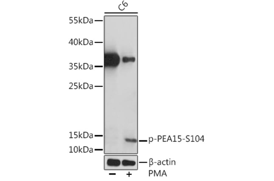 Western Blot - Anti-PEA15 (phospho Ser104) Antibody (A91778) - Antibodies.com