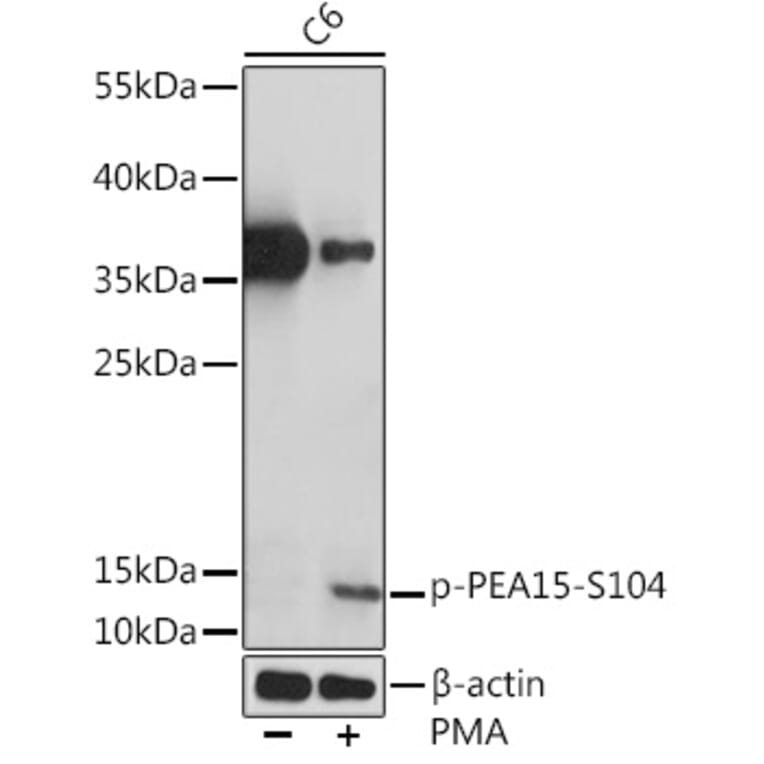 Western Blot - Anti-PEA15 (phospho Ser104) Antibody (A91778) - Antibodies.com