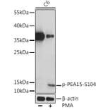 Western Blot - Anti-PEA15 (phospho Ser104) Antibody (A91778) - Antibodies.com