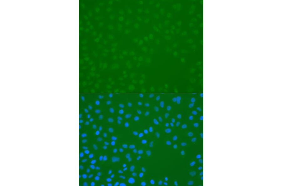 Immunofluorescence - Anti-CHEK1 (phospho S296) Antibody (AP0831) - Antibodies.com