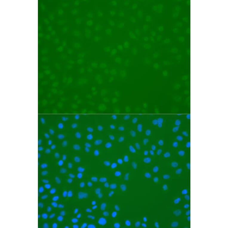 Immunofluorescence - Anti-CHEK1 (phospho S296) Antibody (AP0831) - Antibodies.com