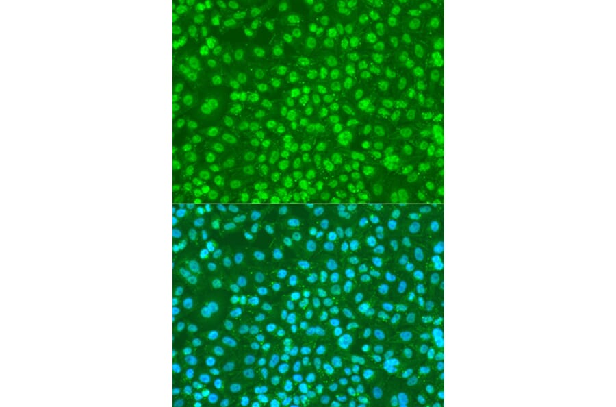 Immunofluorescence - Anti-FANCG (phospho S383) Antibody (AP0833) - Antibodies.com
