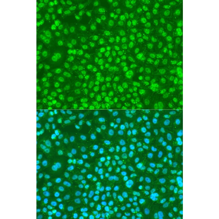 Immunofluorescence - Anti-FANCG (phospho S383) Antibody (AP0833) - Antibodies.com