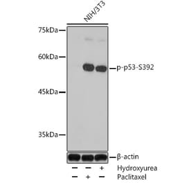 Western Blot - Anti-p53 (phospho Ser392) Antibody (A91789) - Antibodies.com