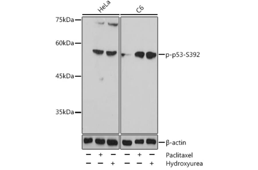 Western Blot - Anti-p53 (phospho Ser392) Antibody (A91789) - Antibodies.com