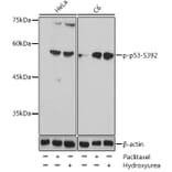 Western Blot - Anti-p53 (phospho Ser392) Antibody (A91789) - Antibodies.com