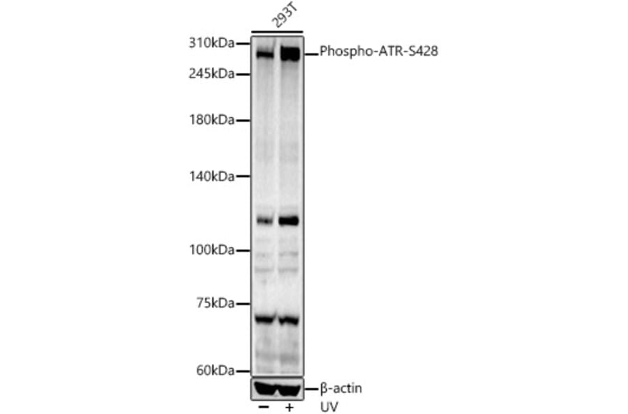 Western Blot - Anti-ATR (phospho Ser428) Antibody (A91791) - Antibodies.com