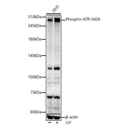 Western Blot - Anti-ATR (phospho Ser428) Antibody (A91791) - Antibodies.com