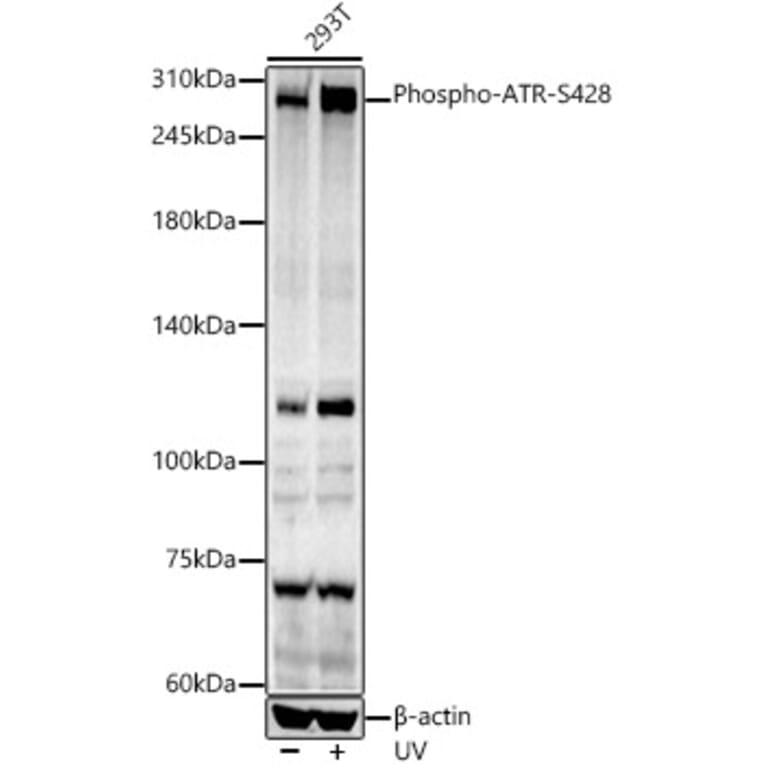 Western Blot - Anti-ATR (phospho Ser428) Antibody (A91791) - Antibodies.com