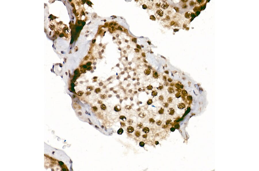 Immunohistochemistry - Anti-ATR (phospho Ser428) Antibody (A91791) - Antibodies.com