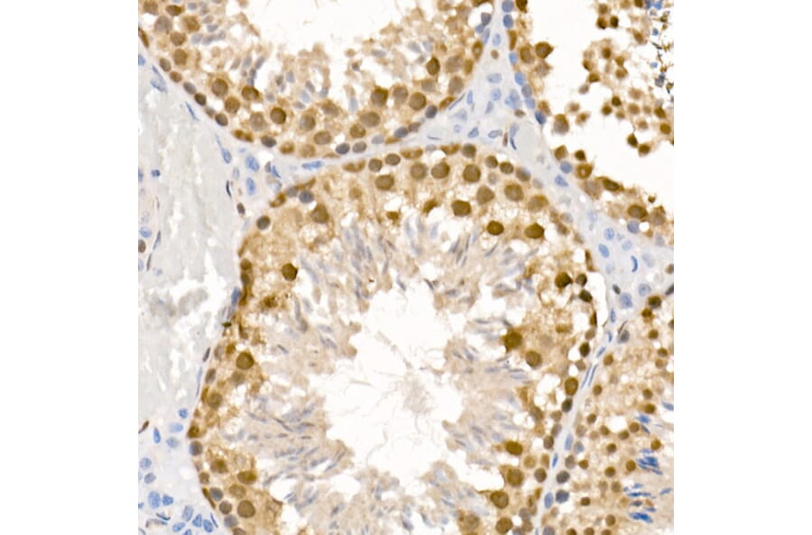 Immunohistochemistry - Anti-ATR (phospho Ser428) Antibody (A91791) - Antibodies.com