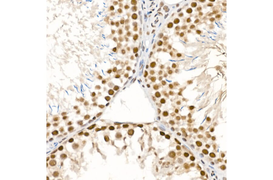 Immunohistochemistry - Anti-ATR (phospho Ser428) Antibody (A91791) - Antibodies.com